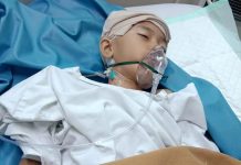 Jadi Korban Laka, Anak di Cikarang Butuh Biaya Operasi Otak